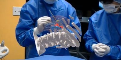 Surgeons to Use MediView XR, AR Goggles, to Give Them X-ray Vision