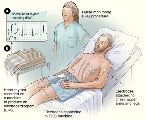 Ecg Wearables Ecg Monitor Hospital