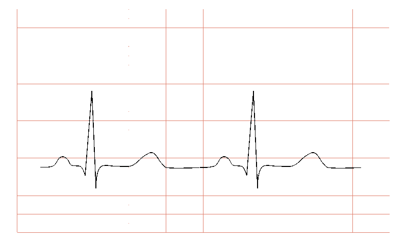 Ecg Wearables Ecg Pulse